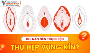 khi-nao-nen-thu-hep-vung-kin