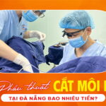 phau-thuat-cat-moi-be-tai-da-nang-bao-nhieu-tien