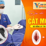 vien-tham-my-violaeva-dia-chi-cat-moi-be-da-nang-uy-tin-hang-dau