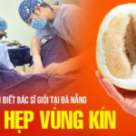 cach-nhan-biet-bac-si-thu-hep-vung-kin-gioi-tai-da-nang