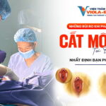 nhung-rui-ro-khi-phau-thuat-cat-moi-be-tai-da-nang-nhat-dinh-ban-phai-biet