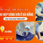 7-loi-ich-va-rui-ro-khi-thu-hep-vung-kin-o-da-nang-ma-phai-dep-nen-biet