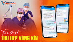 feedback-thu-hep-vung-kin