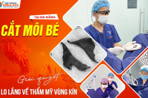 cat-moi-be-da-nang-giai-quyet-lo-lang-ve-tham-my-vung-kin