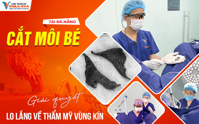 cat-moi-be-da-nang-giai-quyet-lo-lang-ve-tham-my-vung-kin