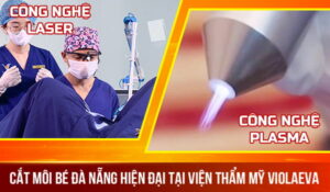 ky-thuat-cat-moi-be-da-nang-hien-dai-tai-vien-tham-my-violaeva