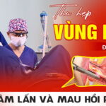 thu-hep-vung-kin-da-nang-it-xam-lan-va-mau-hoi-phuc