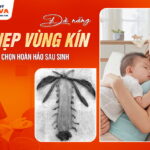 thu-hep-vung-kin-da-nang-su-lua-chon-hoan-hao-sau-sinh