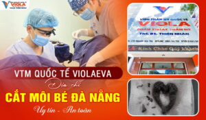 trung-tam-tham-my-vung-kin-violaeva-dia-chi-cat-moi-be-da-nang-uy-tin-va-an-toan