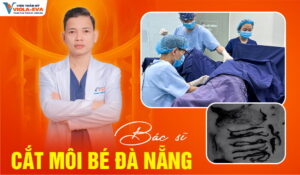 Ths.Bs-thien-nhan-bac-si-cat-moi-be-da-nang-an-toan