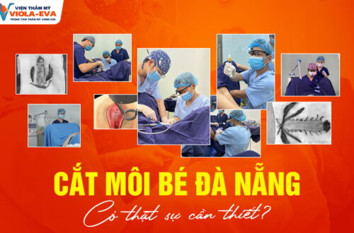 cat-moi-be-da-nang-co-that-su-can-thiet