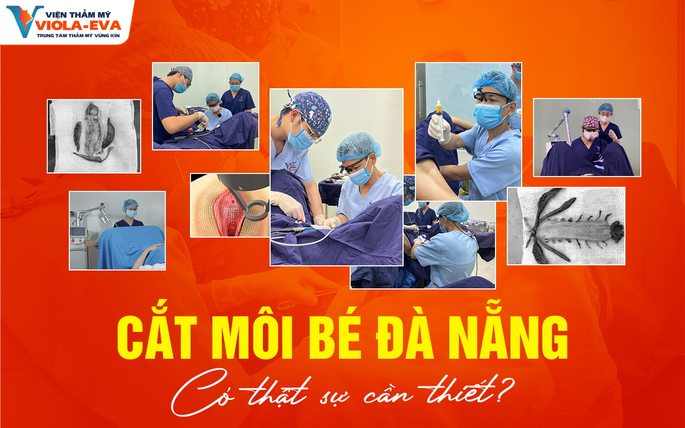 cat-moi-be-da-nang-co-that-su-can-thiet