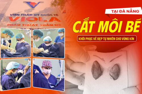 cat-moi-be-da-nang-khoi-phuc-ve-dep-tu-nhien-cho-vung-kin