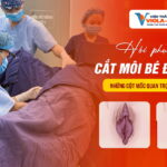 hanh-trinh-hoi-phuc-sau-cat-moi-be-da-nang-nhung-cot-moc-quan-trong-can-biet