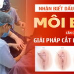 nhan-biet-nhung-dau-hieu-moi-be-can-can-thiep-giai-phap-cat-moi-be-da-nang