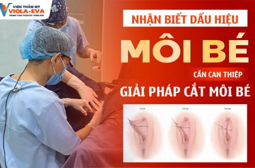 nhan-biet-nhung-dau-hieu-moi-be-can-can-thiep-giai-phap-cat-moi-be-da-nang
