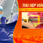 thu-hep-vung-kin-da-nang-bang-laser-co-hieu-qua-khong