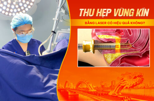 thu-hep-vung-kin-da-nang-bang-laser-co-hieu-qua-khong