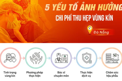 05-yeu-to-anh-huong-den-chi-phi-thu-hep-vung-kin-tai-da-nang
