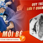 cat-moi-be-da-nang-co-an-toan-khong-quy-trinh-&-luu-y-quan-trong