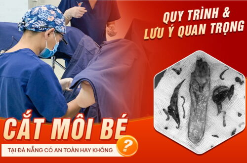 cat-moi-be-da-nang-co-an-toan-khong-quy-trinh-&-luu-y-quan-trong