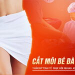 cat-moi-be-da-nang–tham-my-tinh-te-phuc-hoi-nhanh-khong-dau