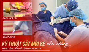 ky-thuat-cat-moi-be-nhe-nhang-khong-dau-tai-trung-tam-tham-my-vung-kin-violaeva