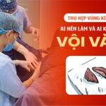 thu-hep-vung-kin-la-gi-ai-nen-lam-va-ai-khong-nen-voi-vang-tai-da-nang