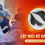 cat-moi-be-da-nang-han-che-seo-hoi-phuc-nhanh