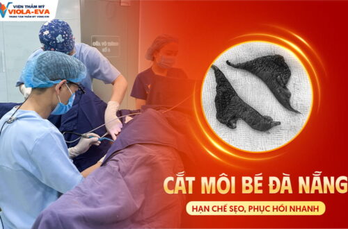 cat-moi-be-da-nang-han-che-seo-hoi-phuc-nhanh