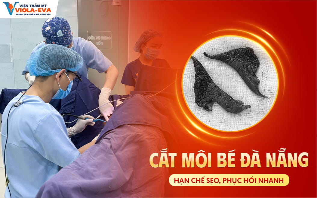 cat-moi-be-da-nang-han-che-seo-hoi-phuc-nhanh