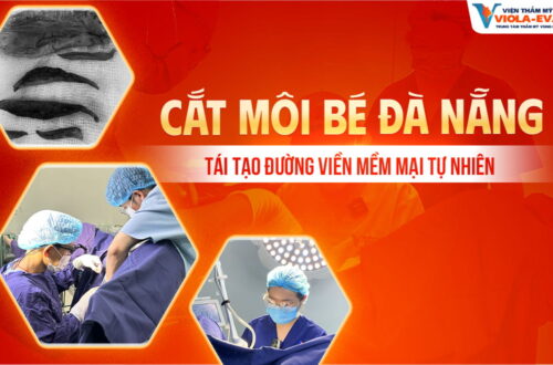 cat-moi-be-da-nang-tai-tao-duong-vien-mem-mai-tu-nhien