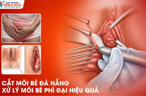 cat-moi-be-da-nang-xu-ly-moi-phi-dai-hieu-qua