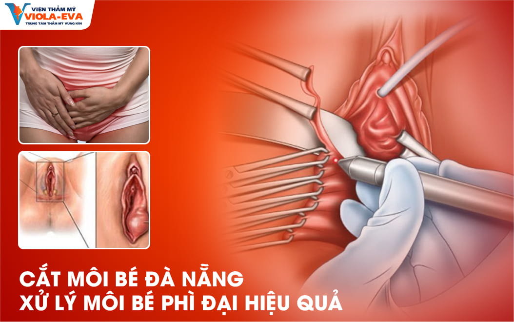 cat-moi-be-da-nang-xu-ly-moi-phi-dai-hieu-qua