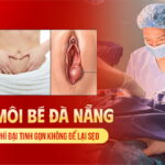 cat-moi-be-da-nang-xu-ly-phi-dai-tinh-gon-khong-de-lai-seo