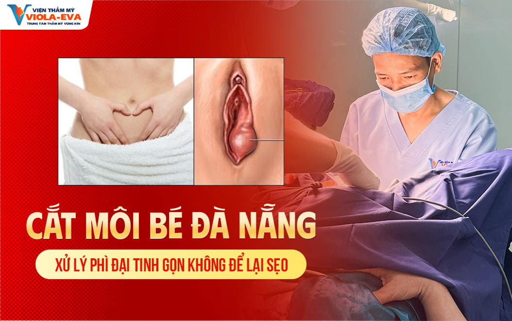 cat-moi-be-da-nang-xu-ly-phi-dai-tinh-gon-khong-de-lai-seo