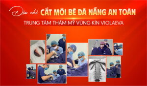 dia-chi-cat-moi-be-da-nang-an-toan-trung-tam-tham-my-vung-kin-violaeva