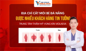 dia-chi-cat-moi-be-da-nang-duoc-nhieu-khach-hang-lua-chon-trung-tam-tham-my-vung-kin-violaeva