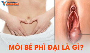 moi-be-phi-dai-la-gi?