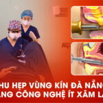 thu-hep-vung-kin-da-nang-bang-cong-nghe-it-xam-lan