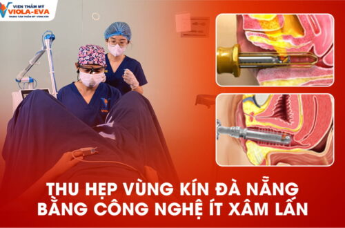 thu-hep-vung-kin-da-nang-bang-cong-nghe-it-xam-lan