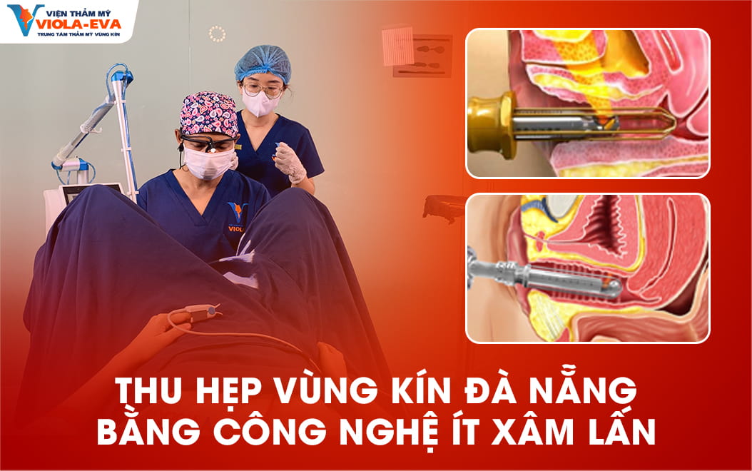 thu-hep-vung-kin-da-nang-bang-cong-nghe-it-xam-lan