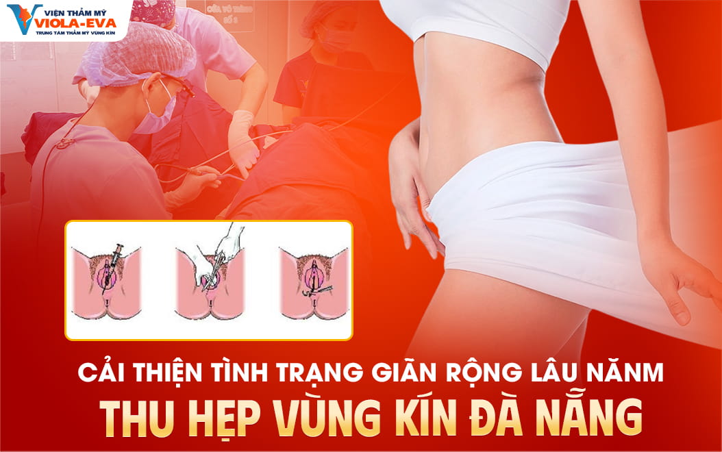 thu-hep-vung-kin-da-nang-cai-thien-tinh-trang-gian-rong-lau-nam