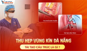 thu-hep-vung-kin-da-nang-tai-tao-cau-truc-la-gi