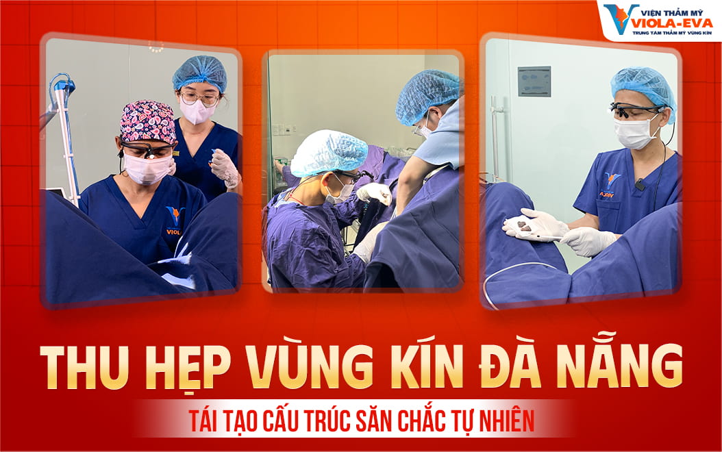 thu-hep-vung-kin-da-nang-tai-tao-cau-truc-san-chac-tu-nhien