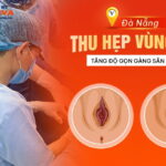 thu-hep-vung-kin-da-nang-tang-do-gon-gang-san-chac