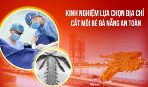 kinh-nghiem-chon-dia-chi-cat-moi-be-da-nang-an-toan