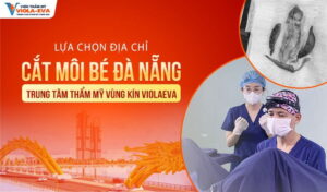 lua-chon-dia-chi-cat-moi-be-da-nang-an-toan-trung-tam-tham-my-vung-kin-violaeva
