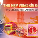 thu-hep-vung-kin-da-nang-phuc-hoi-do-khit-sau-thay-doi-noi-tiet
