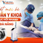 cat-moi-be-chuan-y-khoa-phuc-hoi-nhanh-tai-da-nang
